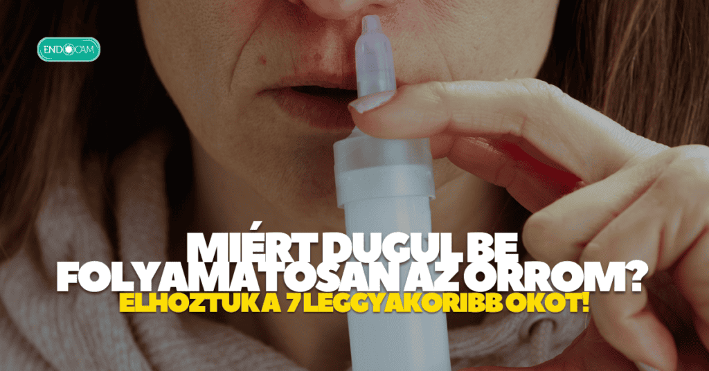 Miért dugul be folyamatosan az orrom?